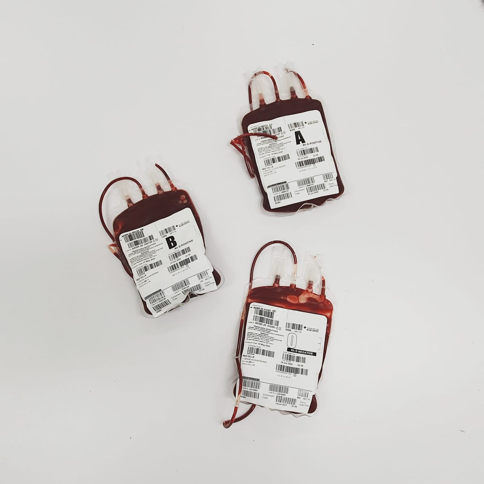 Three donated blood units labelled by blood group on a white surface