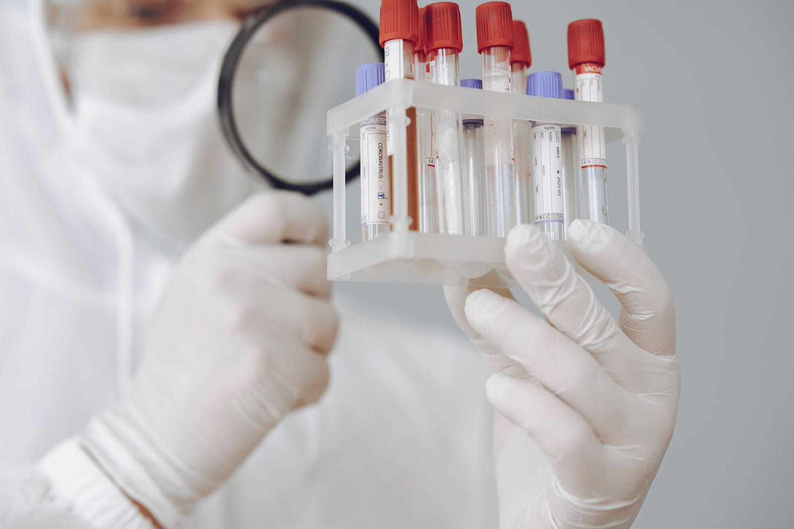 Technician inspecting a rack of blood sample tubes