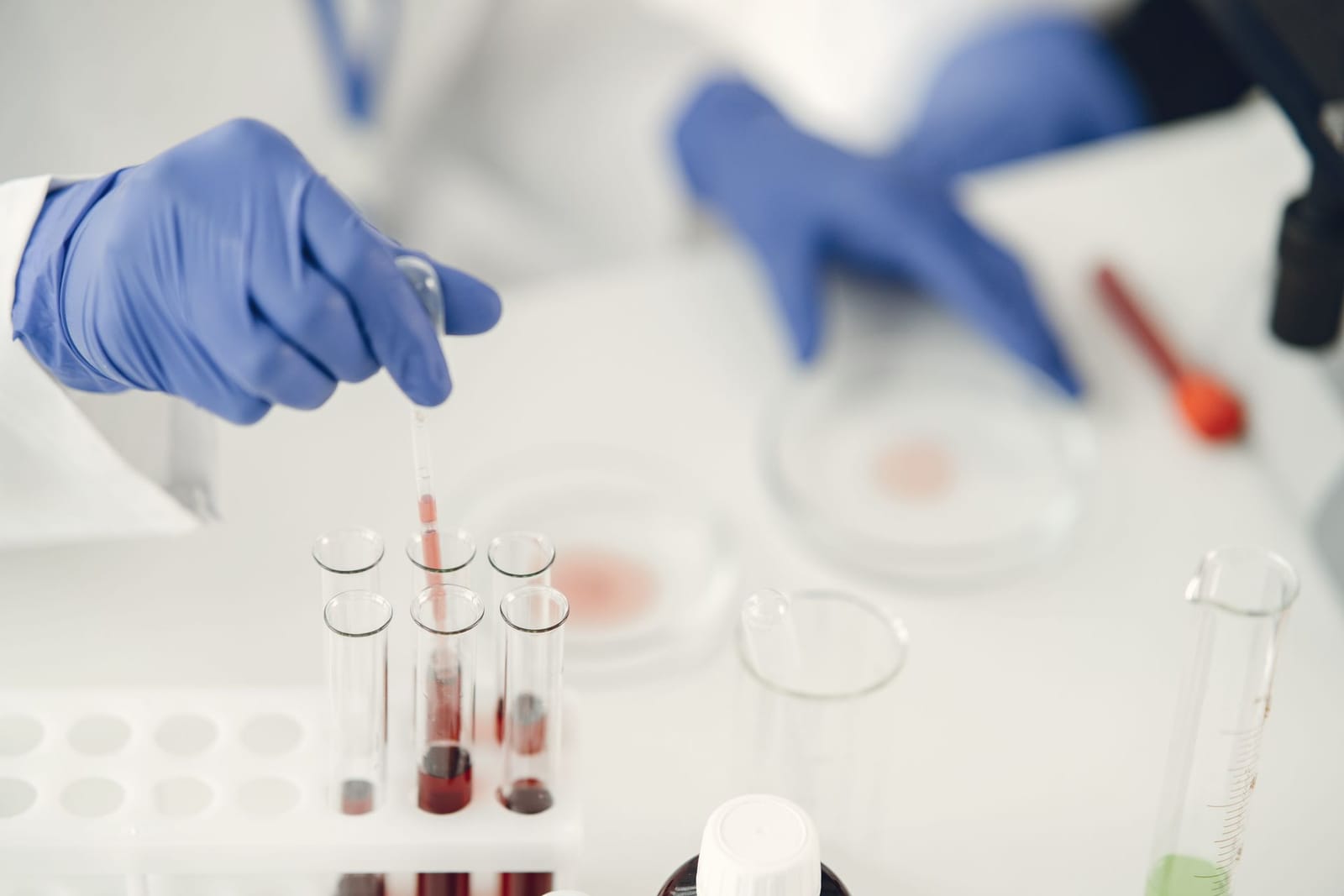 Laboratory technician in blue gloves pipetting blood samples into test tubes